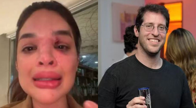 Provas do absurdo! Dentista grava agressões do próprio marido e faz denúncia após ameaças de morte; veja vídeo