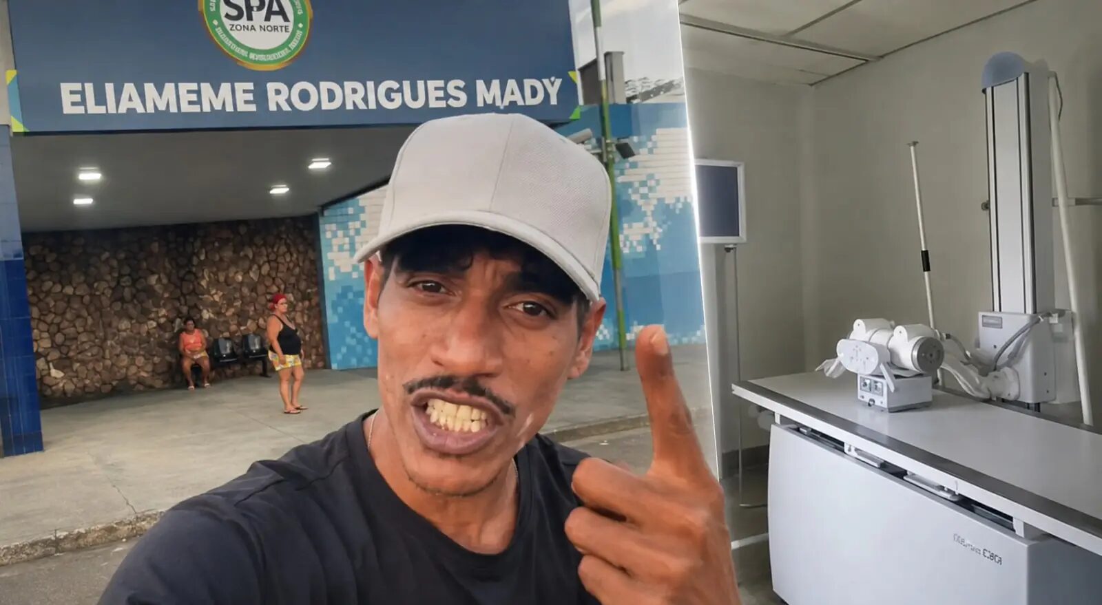 Revolta na saúde: mesmo após promessa de Roberto Cidade, SPA do Galileia volta a ser denunciado por falta de raio-X; veja vídeo