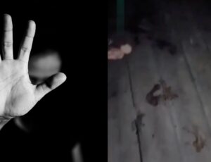 Imagens fortes: após discussão com ex-marido, mulher tem mão decepada por facão; veja vídeo